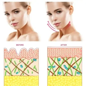 Dispositivo Mini Facial